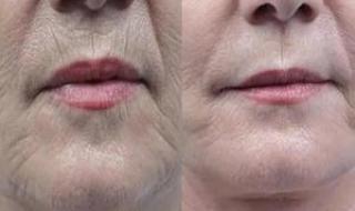 五十岁的女人用什么牌子的抗皱护肤补水护肤品好 50岁抗皱紧致护肤品